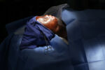 Boston, Massachusetts -- 4/21/2015-- Leo lay on the operating table as Dr. Ehrlichman prepared the area around his face so he could release compressed tissue and repair his nose.
Leo Ikoribitangaza was two years old when he fell into a cooking fire at home in rural Burundi. He suffered severe burns on his face. Without proper treatment he was destined for blindness or possibly death. When his mother learned of a Christian missionary passing through the village, she brought Leo to him and asked for his help. Her plea catalyzed a remarkable team effort to save LeoÕs life. The missionary connected LeoÕs family with Alex Gitungano, a devout Christian in his 20s from the Burundian capital, who volunteered to be LeoÕs caregiver. Alex accompanied the boy to Boston in the summer of 2014 for intensive treatment at Shriners Hospital. A trip that was supposed to last a few months morphed into a year, then longer. At 26, Alex found himself playing the role of single parent in a cold, unfamiliar city, relying on his compassionate instincts, the guidance he felt from God, and the unending generosity of others.